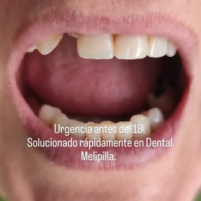 Reel de Dental Melipilla en Instagram